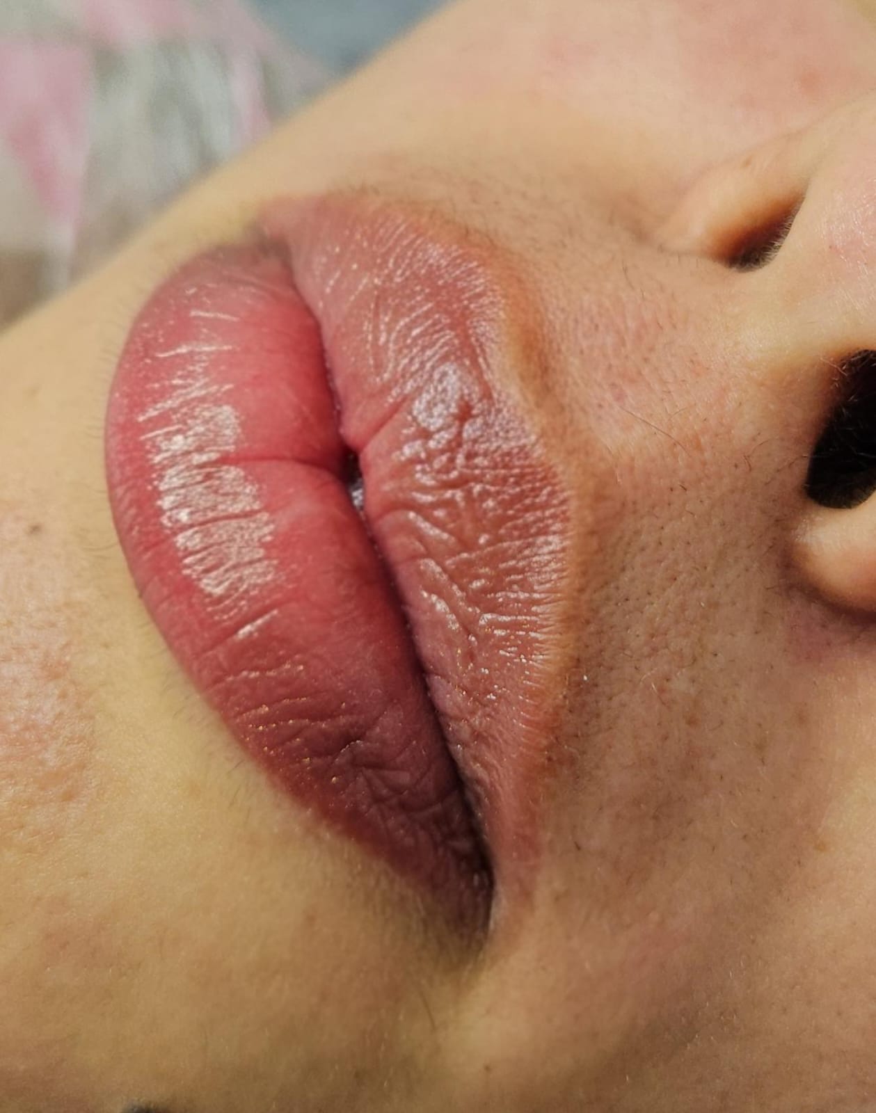 Depilação do Buço